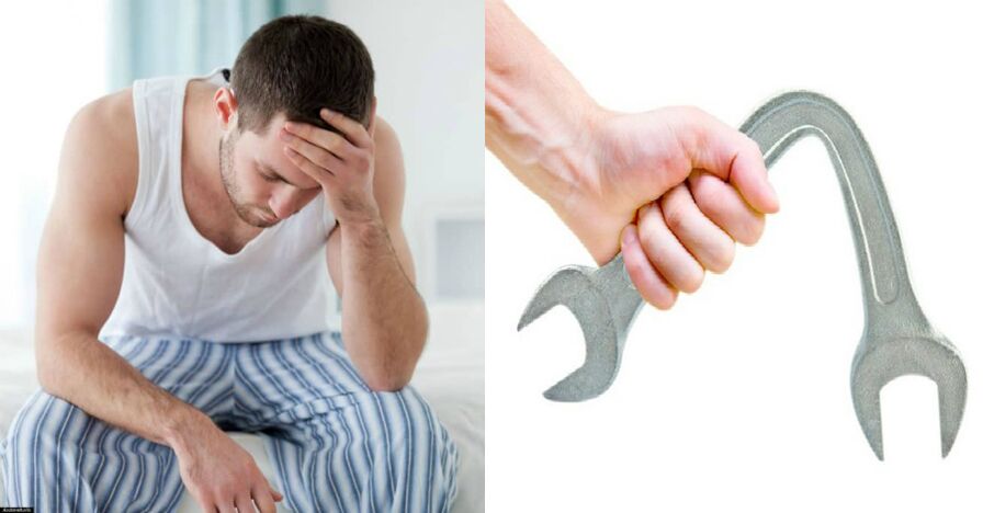 Symptômes de la prostatite