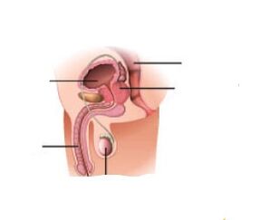 Augmentation du fer de la prostate